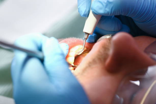 Best Emergency TMJ Treatment in Shil, OH