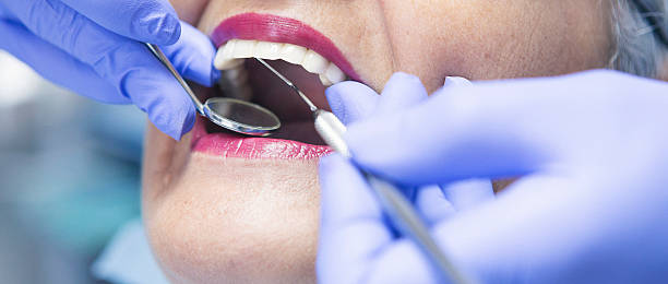 Best Emergency Wisdom Teeth Removal in Shil, OH