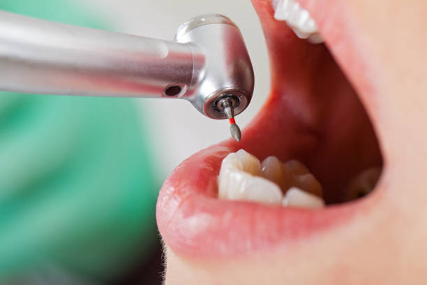 Best Same-Day Emergency Dental Services in Shil, OH
